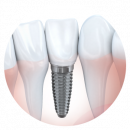 icon with teeth drilled in